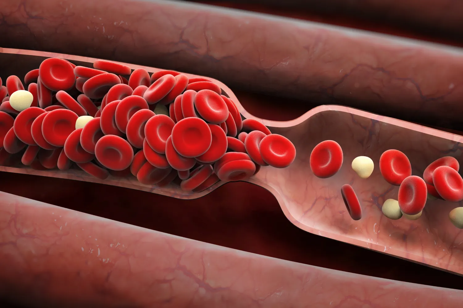 Best Sleeping Position To Prevent Blood Clots